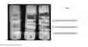 Fig. 07 - Crosslinked Peptide Hydrogels