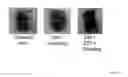 Fig. 55 - Crosslinked Peptide Hydrogels