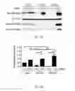 Fig. 04 - Method of preventing polycystic kidney disease and PKD animal model with exogenous neutrophil gelatinase-associated lipocalin