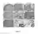 Fig. 06 - Method of preventing polycystic kidney disease and PKD animal model with exogenous neutrophil gelatinase-associated lipocalin