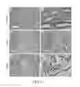 Fig. 07 - Method of preventing polycystic kidney disease and PKD animal model with exogenous neutrophil gelatinase-associated lipocalin