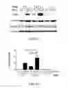 Fig. 08 - Method of preventing polycystic kidney disease and PKD animal model with exogenous neutrophil gelatinase-associated lipocalin