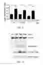 Fig. 09 - Method of preventing polycystic kidney disease and PKD animal model with exogenous neutrophil gelatinase-associated lipocalin