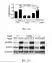 Fig. 22 - Method of preventing polycystic kidney disease and PKD animal model with exogenous neutrophil gelatinase-associated lipocalin