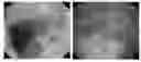 Fig. 01 - Method for prevention or treatment of intractable inflammatory bowel disease