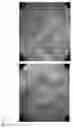Fig. 03 - Method for prevention or treatment of intractable inflammatory bowel disease