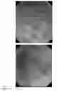 Fig. 04 - Method for prevention or treatment of intractable inflammatory bowel disease