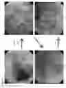 Fig. 06 - Method for prevention or treatment of intractable inflammatory bowel disease