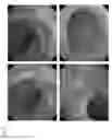 Fig. 07 - Method for prevention or treatment of intractable inflammatory bowel disease