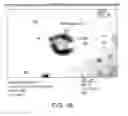 Fig. 03 - Lyophilized compositions comprosing albumin-EGFR paclitaxel nanoparticle complexes