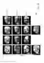 Fig. 19 - Albumin-PD-1 paclitaxel nanoparticle complex compositions and methods of making and using the same