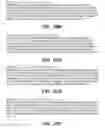 Fig. 35 - SYSTEM AND METHOD FOR OPTOGENETIC THERAPY