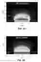 Fig. 99 - SYSTEM AND METHOD FOR OPTOGENETIC THERAPY