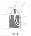 Fig. 05 - METHOD OF DRY DYE DELIVERY FOR STAINING THE EYE