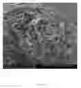 Fig. 10 - ELECTROSPUN BIOCOMPATIBLE FIBER COMPOSITIONS