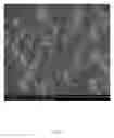 Fig. 14 - ELECTROSPUN BIOCOMPATIBLE FIBER COMPOSITIONS