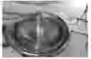 Fig. 01 - ABSORBABLE FIBRIN MICROTHREAD SUTURES FOR REDUCED INFLAMMATION AND SCARRING IN TISSUE LIGATION