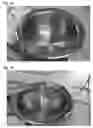 Fig. 02 - ABSORBABLE FIBRIN MICROTHREAD SUTURES FOR REDUCED INFLAMMATION AND SCARRING IN TISSUE LIGATION
