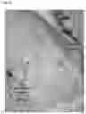 Fig. 07 - ABSORBABLE FIBRIN MICROTHREAD SUTURES FOR REDUCED INFLAMMATION AND SCARRING IN TISSUE LIGATION