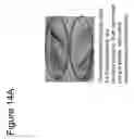 Fig. 15 - ABSORBABLE FIBRIN MICROTHREAD SUTURES FOR REDUCED INFLAMMATION AND SCARRING IN TISSUE LIGATION