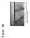 Fig. 16 - ABSORBABLE FIBRIN MICROTHREAD SUTURES FOR REDUCED INFLAMMATION AND SCARRING IN TISSUE LIGATION