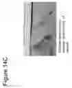 Fig. 17 - ABSORBABLE FIBRIN MICROTHREAD SUTURES FOR REDUCED INFLAMMATION AND SCARRING IN TISSUE LIGATION
