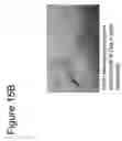 Fig. 19 - ABSORBABLE FIBRIN MICROTHREAD SUTURES FOR REDUCED INFLAMMATION AND SCARRING IN TISSUE LIGATION