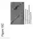 Fig. 20 - ABSORBABLE FIBRIN MICROTHREAD SUTURES FOR REDUCED INFLAMMATION AND SCARRING IN TISSUE LIGATION