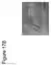 Fig. 23 - ABSORBABLE FIBRIN MICROTHREAD SUTURES FOR REDUCED INFLAMMATION AND SCARRING IN TISSUE LIGATION