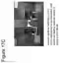 Fig. 24 - ABSORBABLE FIBRIN MICROTHREAD SUTURES FOR REDUCED INFLAMMATION AND SCARRING IN TISSUE LIGATION