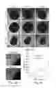 Fig. 07 - COMPOSITIONS AND METHODS FOR SCAFFOLD FORMATION