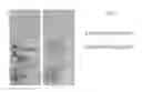 Fig. 06 - Crosslinked peptide hydrogels