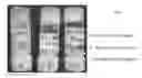 Fig. 07 - Crosslinked peptide hydrogels