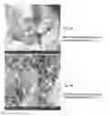 Fig. 09 - Crosslinked peptide hydrogels