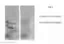 Fig. 06 - Crosslinked peptide hydrogels