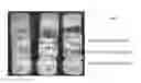 Fig. 07 - Crosslinked peptide hydrogels