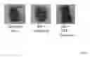 Fig. 52 - Crosslinked peptide hydrogels