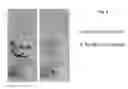 Fig. 06 - Crosslinked peptide hydrogels
