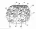 Fig. 01 - Partially resorbable implants and methods