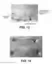 Fig. 10 - High strength biomedical materials