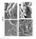 Fig. 32 - Decreasing bacterial responses on nano-modified titanium