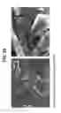 Fig. 34 - Decreasing bacterial responses on nano-modified titanium