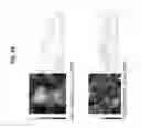 Fig. 40 - Decreasing bacterial responses on nano-modified titanium