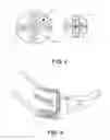 Fig. 03 - INTRODUCER FOR ACCESSING CORONARY SINUS VIA RIGHT PARASTERNAL MEDIASTINOTOMY