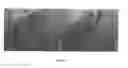 Fig. 04 - Transdermal microneedle drug delivery device and method