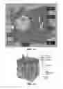 Fig. 18 - Delivery device