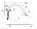 Fig. 01 - Method and apparatus for coupling left ventricle of the heart to the anterior interventricular vein to stimulate collateral development in ischemic regions