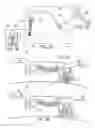 Fig. 02 - Method and apparatus for coupling left ventricle of the heart to the anterior interventricular vein to stimulate collateral development in ischemic regions