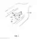 Fig. 02 - Strain relief loop holders for medical leads and systems