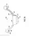 Fig. 03 - Strain relief loop holders for medical leads and systems